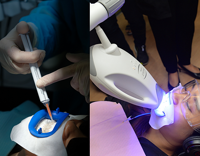 Pairing Teeth Whitening With Spa Treatment – Now That’s A First!